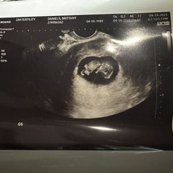 OM Fertility - Ultrasound