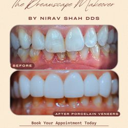 Dreamscape Dental - Smile makeover with veneers