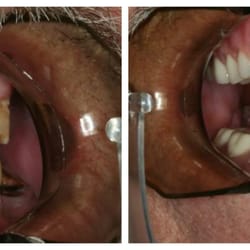 Robison Dental Group - Restorative dentistry procedures