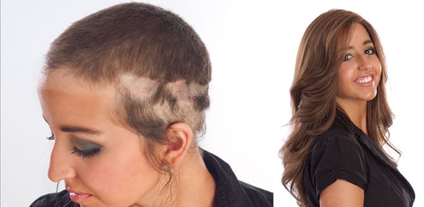 Wig allure hair loss center Clearance