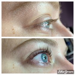 Skin Solutions - Lift & tint - Before and after