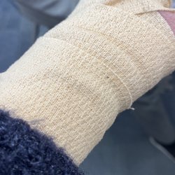CareWell Urgent Care | Fitchburg - Fell on the ice