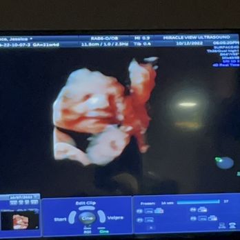 Miracle View 3D/4D Ultrasound - Obstetricians & Gynecologists Near Me - Phoenix, Arizona