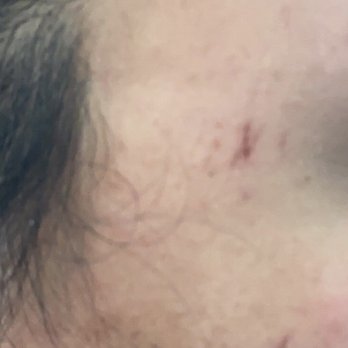 Mandy V Spa & Nails - Burns from wax - Nail Salons Near Me - Albuquerque, New Mexico Mandy V Spa & Nails - Burns from wax - Nail Salons Near Me - Albuquerque, New Mexico