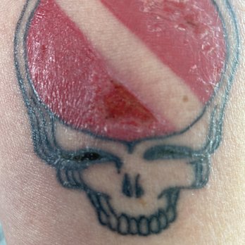 Royal Peacock Tattoo Parlor - 2 weeks later gouging still has not healed. - Tattoo Near Me - Sacramento, California Royal Peacock Tattoo Parlor - 2 weeks later gouging still has not healed. - Tattoo Near Me - Sacramento, California