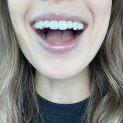 Ossman Harding Dental