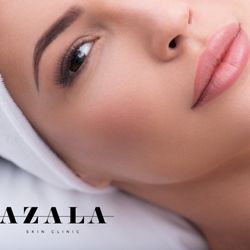 AZALA