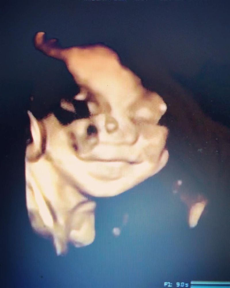 BELLY VISION 14 Photos & 10 Reviews 7918 Edgewood Church Rd