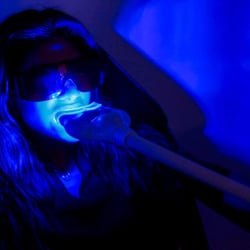 Beauty Bar Medical Clinic - Wavelight Teeth Whitening - 20 Minute session (2-4 shades whiter)
40 Minute Session (4-10 shades whiter)