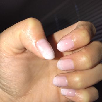 Nail Design & Spa - You can see the bump on my thumb. - Nail Salons Near Me - Gardena, California Nail Design & Spa - You can see the bump on my thumb. - Nail Salons Near Me - Gardena, California