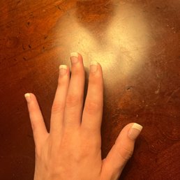 Other nails coming undone Other nails coming undone