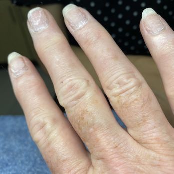 My Nail Spa - Ughh the before pic. - Nail Salons Near Me - Sun City West, Arizona My Nail Spa - Ughh the before pic. - Nail Salons Near Me - Sun City West, Arizona