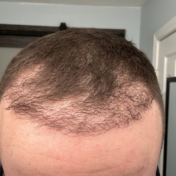 Robotic Hair RX - Hair Loss Centers Near Me - Tempe, Arizona Robotic Hair RX - Hair Loss Centers Near Me - Tempe, Arizona