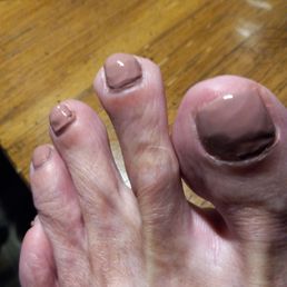 Toes, old sticky polish, awful job Toes, old sticky polish, awful job