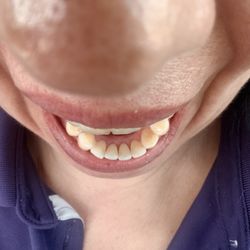 TLC Dental - Tamarac