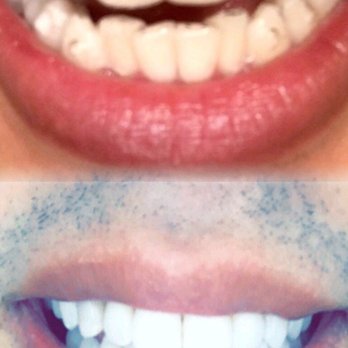 Fresh Dental Concord - Cosmetic Dentists Near Me - Concord, North Carolina Fresh Dental Concord - Cosmetic Dentists Near Me - Concord, North Carolina