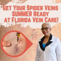 Florida Vein Care - Spider Veins