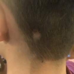 Five Star Hair Salon - You get what you pay for. Not sure how they managed to take such a huge chunk out leaving this bald patch.