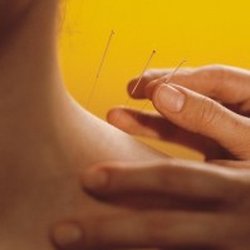 Acupuncture & Natural Healing Therapies