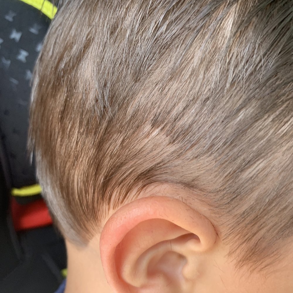 Ear is swollen Ear is swollen
