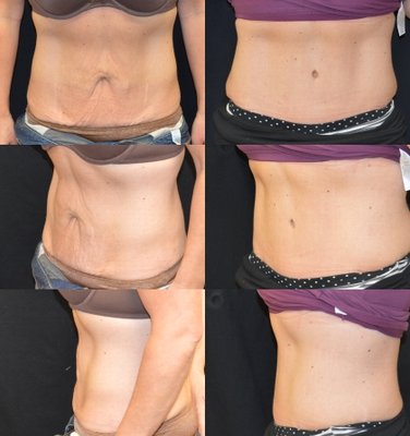 Baroody Plastic Surgery by null