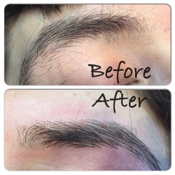 This Is Our Best Seller Product Vita Leaf Ingrown Hair Serum It