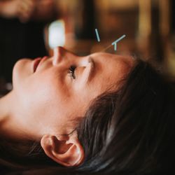 Devine Acupuncture - Cosmetic acupuncture- a natural anti-aging therapy