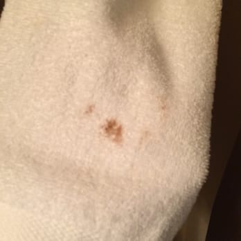 Best Western Heritage Inn - Stained towels!  Gross! - Hotels Near Me - Concord, California