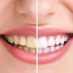 Forest Edge Dental Care
