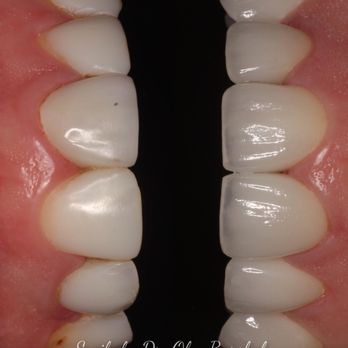 Oleg Borshch, DDS - Cosmetic Dentists Near Me - New York, New York Oleg Borshch, DDS - Cosmetic Dentists Near Me - New York, New York