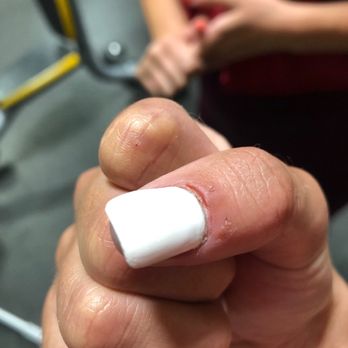 G Nails - Injury from the electric buffer - Nail Salons Near Me - Tucson, Arizona G Nails - Injury from the electric buffer - Nail Salons Near Me - Tucson, Arizona