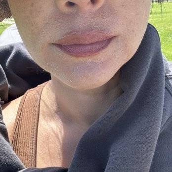 London Look - 30 days after lip blush ; just lip balm on - Permanent Makeup Near Me - Alameda, California London Look - 30 days after lip blush ; just lip balm on - Permanent Makeup Near Me - Alameda, California