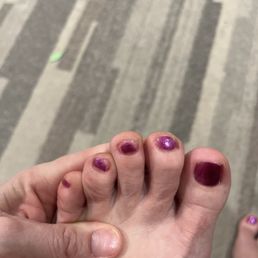 Bad pedicure Bad pedicure