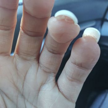 Nails by Li - Cyndy’s Nails - All the glue stuck to my skin - Nail Technicians Near Me - Humble, Texas Nails by Li - Cyndy’s Nails - All the glue stuck to my skin - Nail Technicians Near Me - Humble, Texas