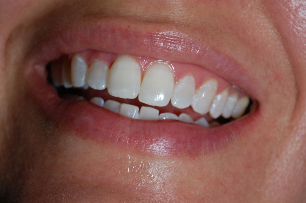 GYURICZA & HARTMAN FAMILY AND COSMETIC DENTISTRY Updated September