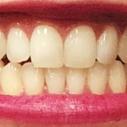 Central Dental Family Dentistry - Feeling brand new!
