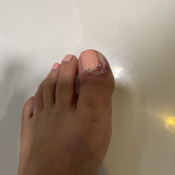 Gem Nail Bar - After podiatrist visit - Nail Salons Near Me - Long Beach, California Gem Nail Bar - After podiatrist visit - Nail Salons Near Me - Long Beach, California