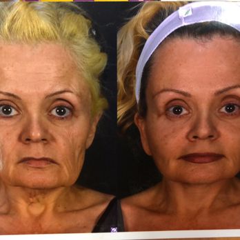 Plastic Surgery Vegas - Medical Spas Near Me - Las Vegas, Nevada