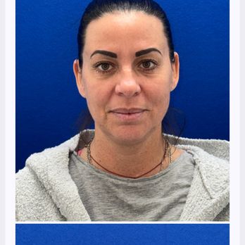 Cruise Plastic Surgery - Cosmetic Surgeons Near Me - Newport Beach, California Cruise Plastic Surgery - Cosmetic Surgeons Near Me - Newport Beach, California