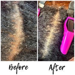 The J.Sarne Experience - The J.Sarne' Signature Scalp Therapy Treatment Before & After
