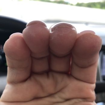 Lavish Nails & Spa - Uneven thickness, spillage on to fingertips, nails adhered to skin. - Nail Salons Near Me - Cedar Park, Texas