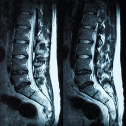 David Hiller, MD