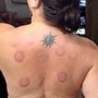 Life Centered Acupuncture Care