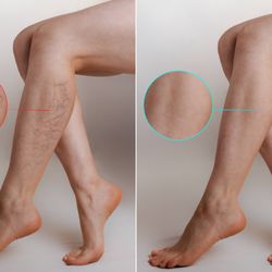 CURA Vein Doctors - Vein Treatment Center