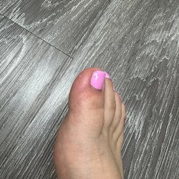 Day after getting a pedicure