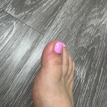 Lee Nails Bar - Day after getting a pedicure - Nail Salons Near Me - San Antonio, Texas