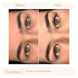 Haven Esthetics - Before and After