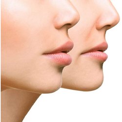DERMAL FILLERS
-Soften aging and accent your best features
-Plump lips, raise cheekbones, reduce jowls or sharpen jawline