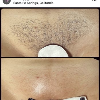 Beauty Unleashed - Brazilian waxing. Stop irritating your skin when shaving and dealing with ingrown hairs. Switch to waxing and your skin will thank you ! - Waxing Near Me