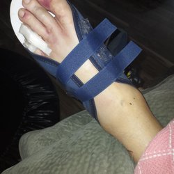 Resurgens Orthopaedics - This is only photos of his foot that I talked about in the review as well as his shoulder
